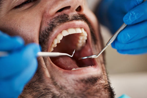 Best Emergency Dental Services for Seniors in Ellenville, NY